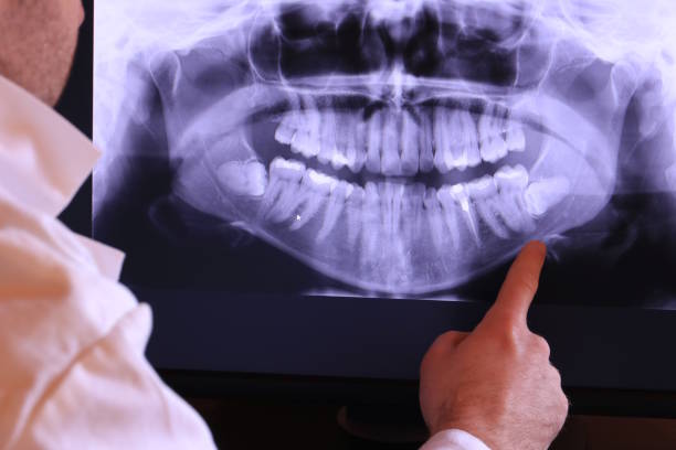 Best Orthodontic Emergency Dentist in Epworth, IA